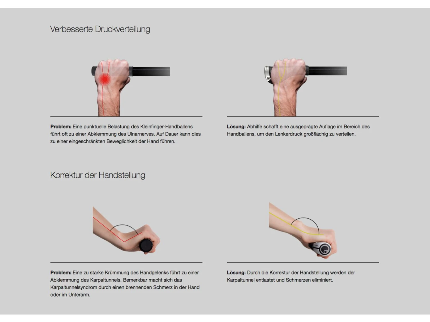 Ergon GS2 Small Mit 2-Finger Barend, Schwarz 5 Ergon GS2 Small Mit 2-Finger Barend, Schwarz – Bild 3